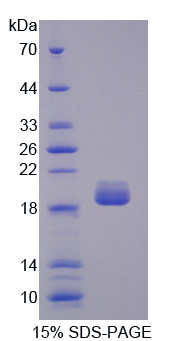 胰腺型磷脂酶A2(pPLA2)重组蛋白,Recombinant Phospholipase A2, Pancreas (pPLA2)