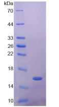 胰高血糖素样肽1受体(GLP1R)重组蛋白,Recombinant Glucagon Like Peptide 1 Receptor (GLP1R)