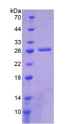 胰岛细胞自身抗原1(ICA1)重组蛋白,Recombinant Islet Cell Autoantigen 1 (ICA1)
