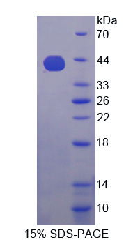 胰岛素样生长因子2-mRNA结合蛋白3(IGF2BP3)重组蛋白,Recombinant Insulin Like Growth Factor 2 mRNA Binding Protein 3 (IGF2BP3)