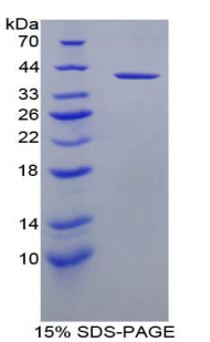 胰岛素样生长因子1(IGF1)重组蛋白,Recombinant Insulin Like Growth Factor 1 (IGF1)