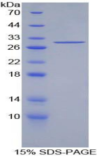 胰島素受體底物1(IRS1)重組蛋白,Recombinant Insulin Receptor Substrate 1 (IRS1)