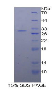 胰岛素降解酶(IDE)重组蛋白,Recombinant Insulin Degrading Enzyme (IDE)