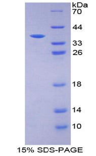 胰島素(INS)重組蛋白,ecombinant Insulin (INS)