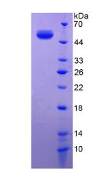 胰弹性蛋白酶(ELA1)重组蛋白,Recombinant Pancreatic Elastase 1 (ELA1)