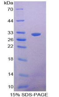 一氧化氮合酶运输因子(NOSTRIN)重组蛋白,Recombinant Nitric Oxide Synthase Trafficker (NOSTRIN)