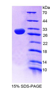 一氧化氮合酶1衔接蛋白(NOS1AP)重组蛋白,Recombinant Nitric Oxide Synthase 1 Adaptor Protein (NOS1AP)