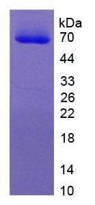 眼小畸形关联转录因子(MITF)重组蛋白,Recombinant Microphthalmia Associated Transcription Factor (MITF)