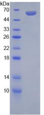 盐皮质激素受体(MR)重组蛋白,Recombinant Mineralocorticoid Receptor (MR)