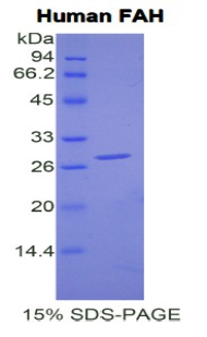 延胡索二酰乙酰乙酸水解酶(FAH)重組蛋白,Recombinant Fumarylacetoacetate Hydrolase (FAH)