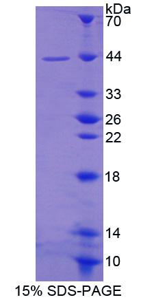 亚铁螯合酶(FECH)重组蛋白,Recombinant Ferrochelatase (FECH)