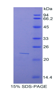 亚硫酸盐氧化酶(SUOX)重组蛋白,Recombinant Sulfite Oxidase (SUOX)