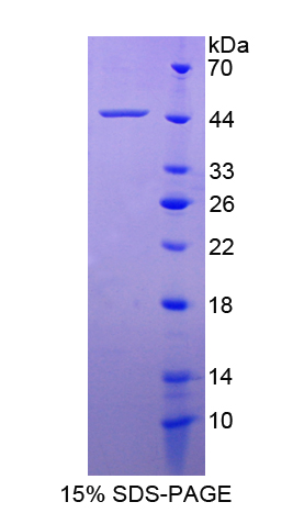 血小板衍生生长因子D(PDGFD)重组蛋白,Recombinant Platelet Derived Growth Factor D (PDGFD)