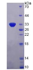 血小板衍生生长因子B(PDGFB)重组蛋白,Recombinant Platelet Derived Growth Factor Subunit B (PDGFB)