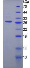 血小板型磷酸果糖激酶(PFKP)重組蛋白,ecombinant Phosphofructokinase, Platelet (PFKP)