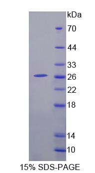 血小板反應(yīng)蛋白解整合素金屬肽酶9(ADAMTS9)重組蛋白,Recombinant A Disintegrin And Metalloproteinase With Thrombospondin 9 (ADAMTS9)