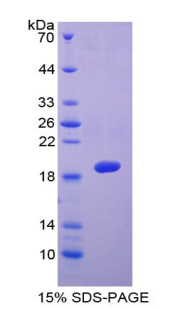 血小板反應(yīng)蛋白解整合素金屬肽酶5(ADAMTS5)重組蛋白,Recombinant A Disintegrin And Metalloproteinase With Thrombospondin 5 (ADAMTS5)