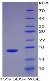 血小板反應(yīng)蛋白解整合素金屬肽酶4(ADAMTS4)重組蛋白,Recombinant A Disintegrin And Metalloproteinase With Thrombospondin 4 (ADAMTS4)