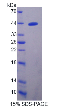 血小板反应蛋白解整合素金属肽酶16(ADAMTS16)重组蛋白,Recombinant A Disintegrin And Metalloproteinase With Thrombospondin 16 (ADAMTS16)