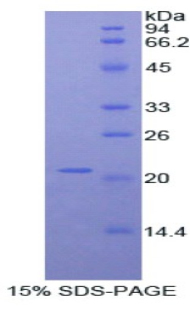 血小板反应蛋白解整合素金属肽酶12(ADAMTS12)重组蛋白,Recombinant A Disintegrin And Metalloproteinase With Thrombospondin 12 (ADAMTS12)