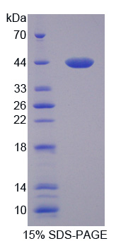 血小板反应蛋白解整合素金属肽酶10(ADAMTS10)重组蛋白,Recombinant A Disintegrin And Metalloproteinase With Thrombospondin 10 (ADAMTS10)