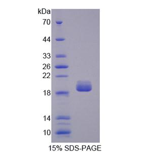 胰腺型磷脂酶A2(pPLA2)重组蛋白