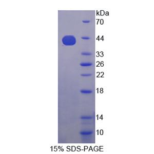 胰岛素样生长因子2-mRNA结合蛋白3(IGF2BP3)重组蛋白,Recombinant Insulin Like Growth Factor 2 mRNA Binding Protein 3 (IGF2BP3)