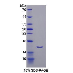 胰岛素受体底物3(IRS3)重组蛋白