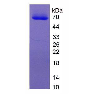 眼小畸形关联转录因子(MITF)重组蛋白,Recombinant Microphthalmia Associated Transcription Factor (MITF)