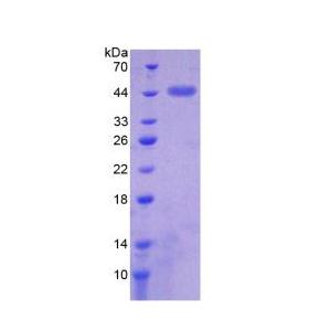 岩藻糖基转移酶8(FUT8)重组蛋白,Recombinant Fucosyltransferase 8 (FUT8)