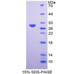 岩藻糖基转移酶3(FUT3)重组蛋白,Recombinant Fucosyltransferase 3 (FUT3)