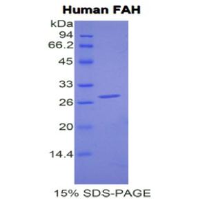 延胡索二酰乙酰乙酸水解酶(FAH)重组蛋白
