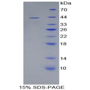 血型糖蛋白C(GYPC)重组蛋白,Recombinant Glycophorin C (GYPC)