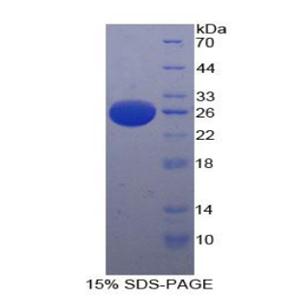 血小板激活因子乙酰水解酶Ⅰb3(PAFAH1B3)重组蛋白,Recombinant Platelet Activating Factor Acetylhydrolase Ib3 (PAFAH1B3)