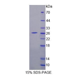 血小板反应蛋白解整合素金属肽酶9(ADAMTS9)重组蛋白