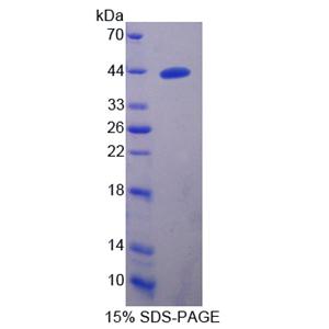 血小板反应蛋白解整合素金属肽酶16(ADAMTS16)重组蛋白