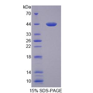 血小板反应蛋白解整合素金属肽酶10(ADAMTS10)重组蛋白