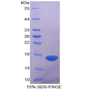 血小板反应蛋白解整合素金属肽酶1(ADAMTS1)重组蛋白