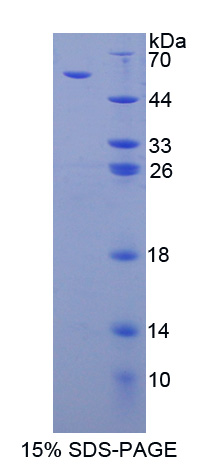 血小板反应蛋白3(THBS3)重组蛋白,Recombinant Thrombospondin 3 (THBS3)