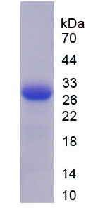 血小板反应蛋白2(THBS2)重组蛋白,Recombinant Thrombospondin 2 (THBS2)