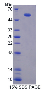 血栓调节蛋白(TM)重组蛋白,Recombinant Thrombomodulin (TM)