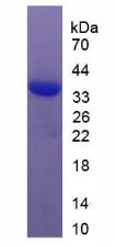 血清反应因子(SRF)重组蛋白,Recombinant Serum Response Factor (SRF)