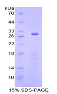 血清/糖皮质激素调节激酶3(SGK3)重组蛋白,Recombinant Serum/Glucocorticoid Regulated Kinase 3 (SGK3)