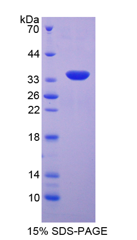 血清/糖皮质激素调节激酶2(SGK2)重组蛋白,Recombinant Serum/Glucocorticoid Regulated Kinase 2 (SGK2)