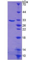 血清/糖皮質(zhì)激素調(diào)節(jié)激酶1(SGK1)重組蛋白,Recombinant Serum/Glucocorticoid Regulated Kinase 1 (SGK1)