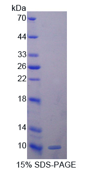 血浆谷胱甘肽过氧化物酶(GPX3)重组蛋白,Recombinant Glutathione Peroxidase 3, Plasma (GPX3)