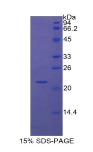 血管细胞粘附分子1(VCAM1)重组蛋白,Recombinant Vascular Cell Adhesion Molecule 1 (VCAM1)