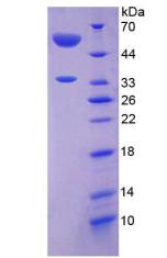 血管生成素樣蛋白4(ANGPTL4)重組蛋白,Recombinant Angiopoietin Like Protein 4 (ANGPTL4)