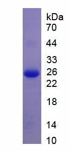 血管生成素样蛋白3(ANGPTL3)重组蛋白,Recombinant Angiopoietin Like Protein 3 (ANGPTL3)