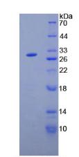 血管生成素样蛋白2(ANGPTL2)重组蛋白,Recombinant Angiopoietin Like Protein 2 (ANGPTL2)